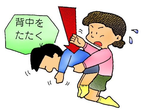 背部叩打法イラスト
